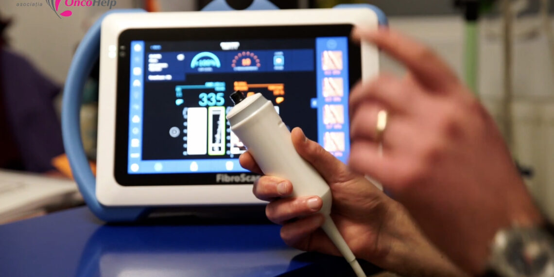Fibroscan, aparatul care evaluează noninvaziv starea de sănătate a ficatului, disponibil la Oncohelp