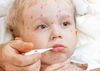 Ministerul Sănătății a declarat epidemie de rujeolă în Românie!