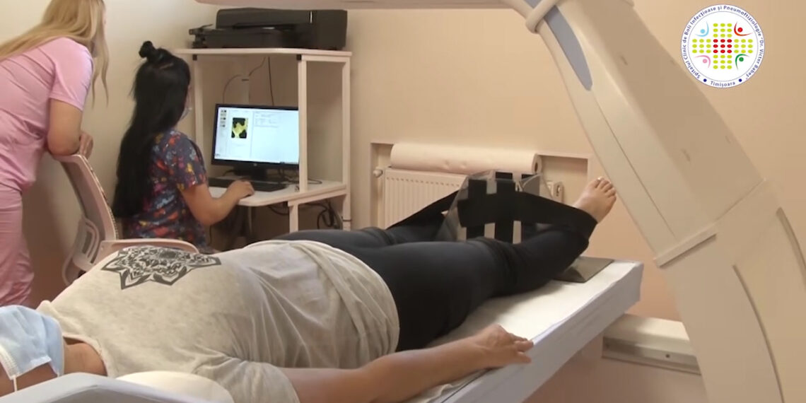 Se poate face, la Babeș, investigația care ne dă informații despre sănătatea oaselor și riscul producerii unor fracturi