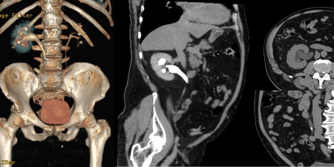 Urografii gratuite la Babeș