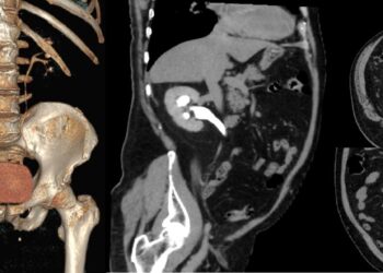 Urografii gratuite la Babeș  
