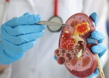 Spitalul Clinic CF Timișoara, inclus în Programul Național de Tratament pentru o boală rară, care poate fi ținută sub control