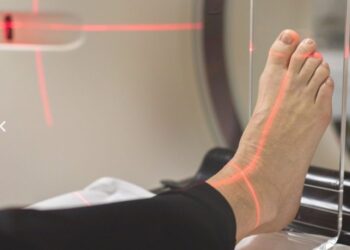 În cadrul Asociației OncoHelp, pacienții au acces la radioterapia pentru tratamentul durerii și reducerea inflamației