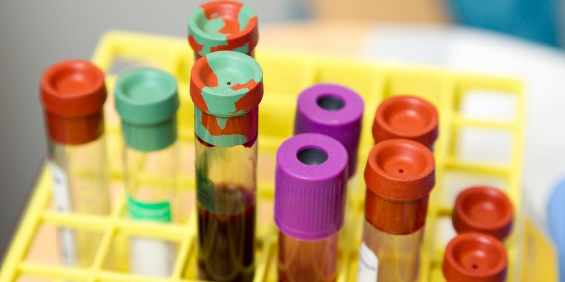 Ziua Mondială a Hemofiliei 2025 marcată prin două evenimente importante organizate la Buziaș