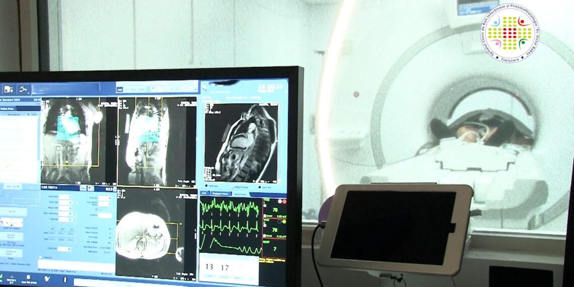 Procedură unică în vestul țării într-un spital public – RMN-ul cardiac de stres. La Spitalul Victor Babeș, investigația este realizată cu ajutorul RMN-ului de 3 Tesla