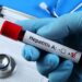Vaccinul hepatic A. Ce este și cât e de important