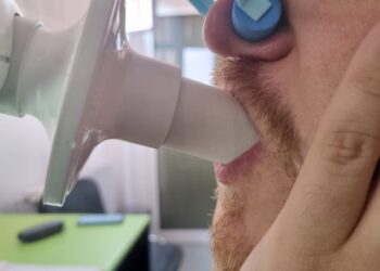 Test de provocare cu metacolină. Spitalul „Victor Babeș”, singura unitate sanitară din vestul României care a implementat această procedură