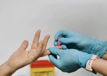 Program de screening pentru depistarea hepatitei C la Spitalul Clinic CF Timișoara. Pacienții pot beneficia de testare si tratamente gratuite