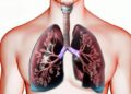 Emfizemul pulmonar: când plămânii nu mai pot elimina aerul corect