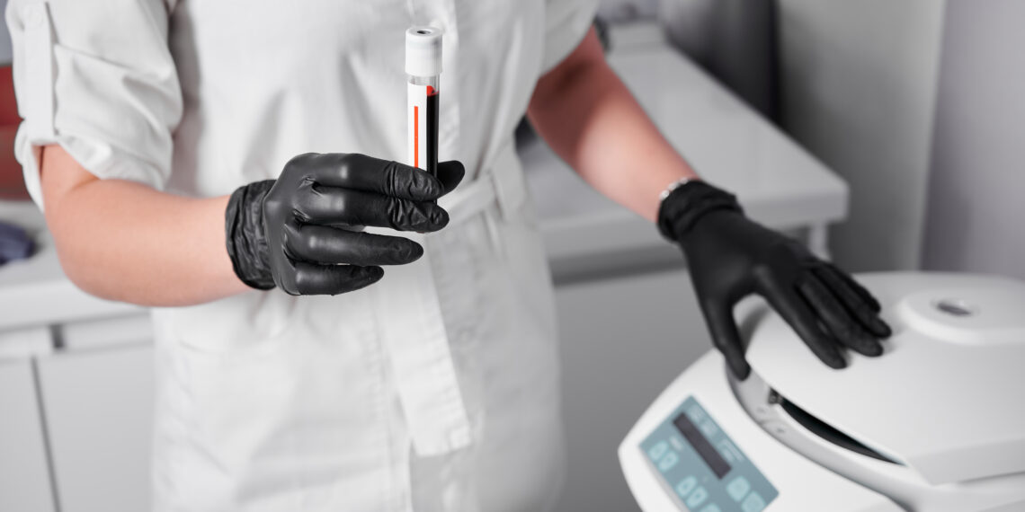 Investiție de 10 milioane de lei la Spitalul Județean Timișoara: diagnostic mai rapid și mai precis pentru pacienții cu cancer