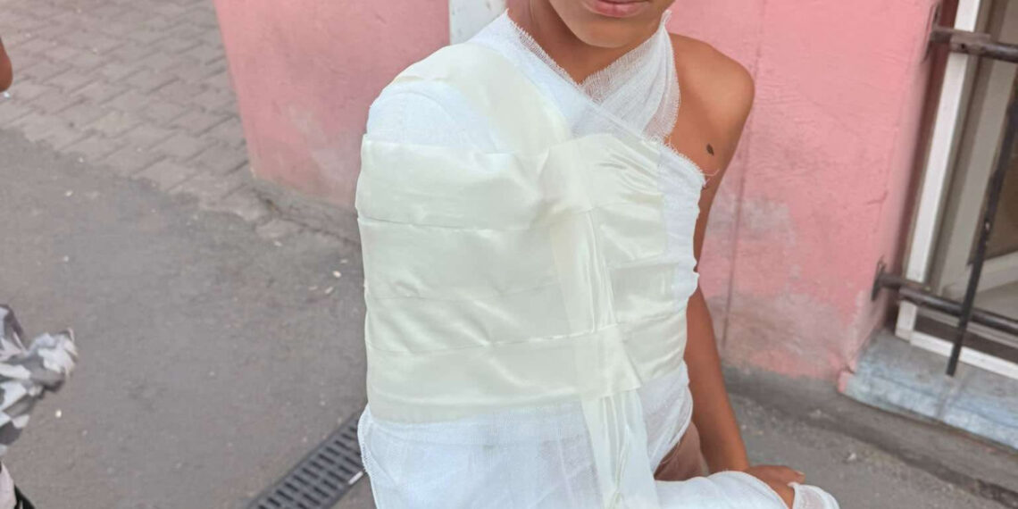 Bătaie între doi elevi la Chevereșu Mare. Un copil de 11 ani a ajuns la spital cu fractură de braț
