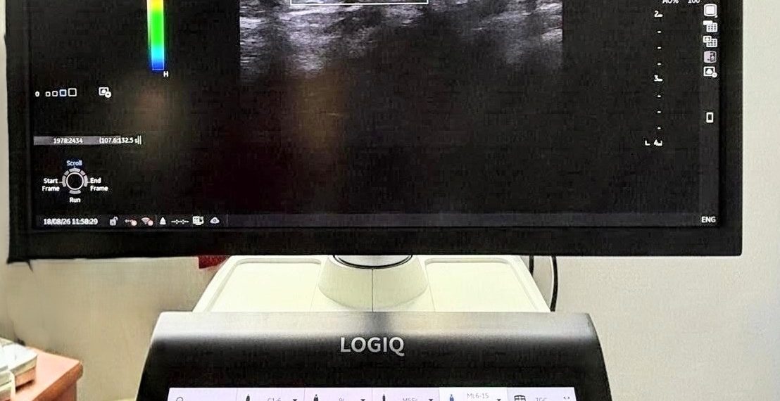 Ecograf de ultimă generație cu modul de elastografie. Aparatul a intrat în dotarea OncoHelp