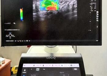 Ecograf de ultimă generație cu modul de elastografie. Aparatul a intrat în dotarea OncoHelp