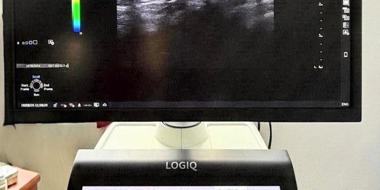 Ecograf de ultimă generație cu modul de elastografie. Aparatul a intrat în dotarea OncoHelp